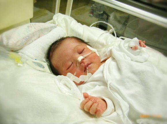 チューブがついたわが子と対面